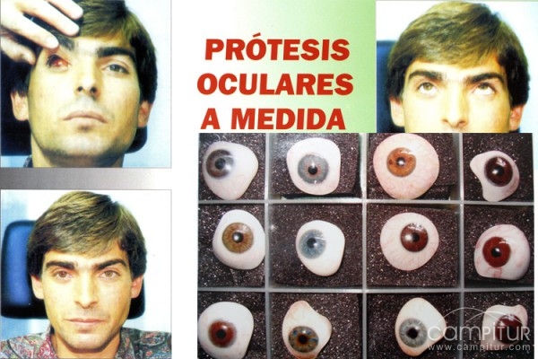 OPTICALIA CANÓNICO