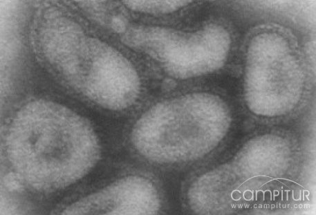 Segundo caso sospechoso de “nueva gripe” en Extremadura 