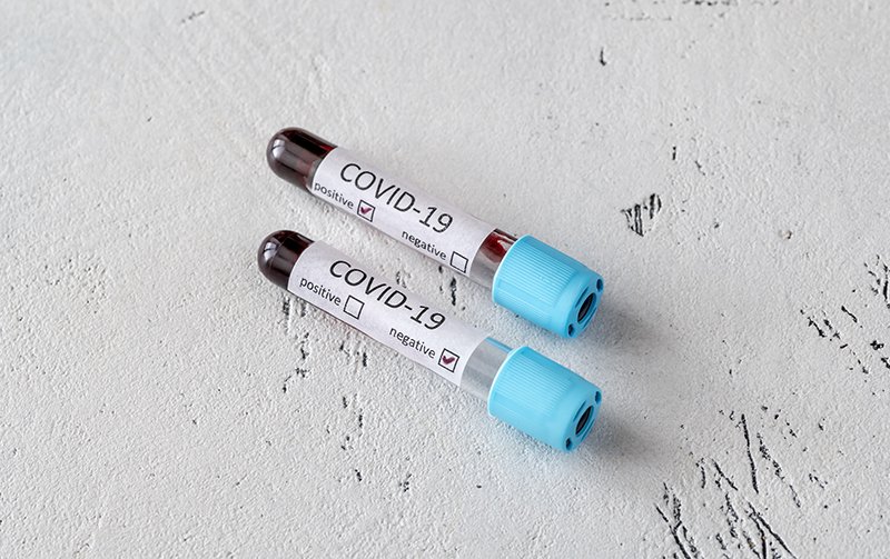 Covid-19 Área de Salud Llena -Zafra