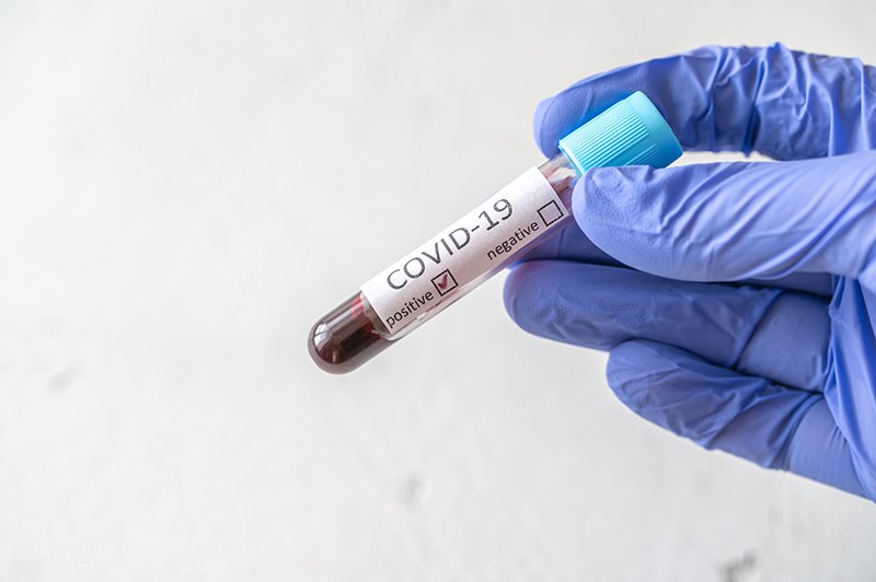 Actualidad Covid-19 Área de Salud Llerena-Zafra 