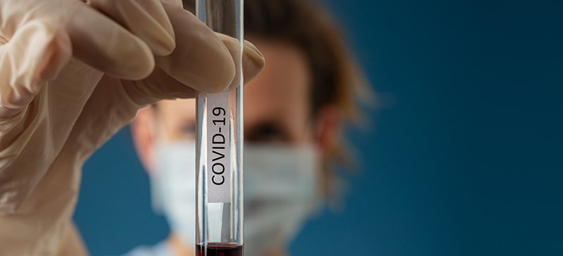 Actualidad Covid-19 Área de Salud Llerena-Zafra 
