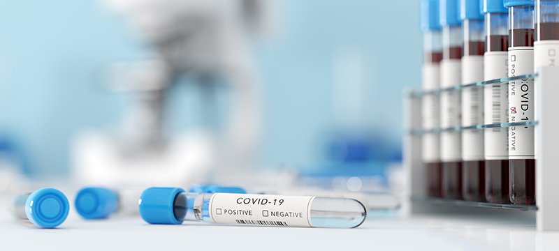 Actualidad Covid-19 Área Sanitaria Llerena-Zafra 