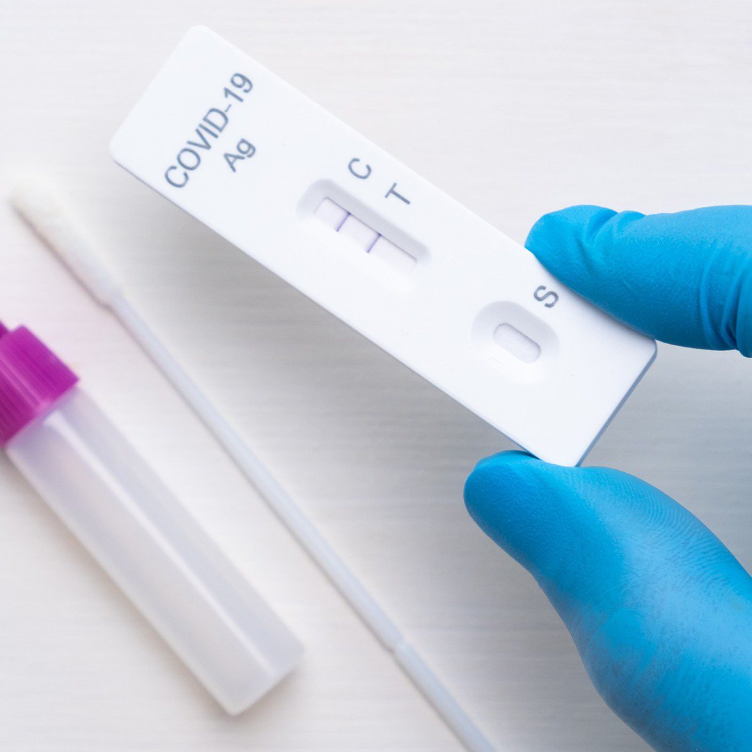 El Centro de Salud de Azuaga retoma los tests de antígenos 