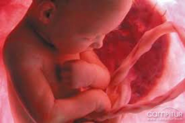 El "ordeño" del cordón umbilical mejora el flujo de sangre en los bebés prematuros
